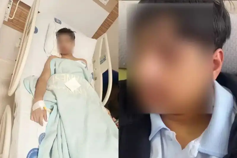 Antalya'da Akran Zorbalığı: Arkadaşının Çenesini Kıran Genç Şok Yarattı