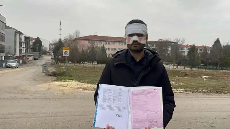 Öğretmenden Şok Edici Hareket: Öğretmen Yüzüne Sıcak Çay Attı!