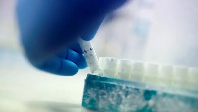 Tıbbi Skandal: 85 Sperm Donörü Binlerce Çocuğa Baba Oldu